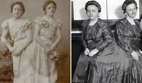 Одна из сиамских сестёр-близнецов забеременела и родила сына: вот как выглядит их ребёнок